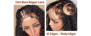What Is Type 4 Hairline Wigs